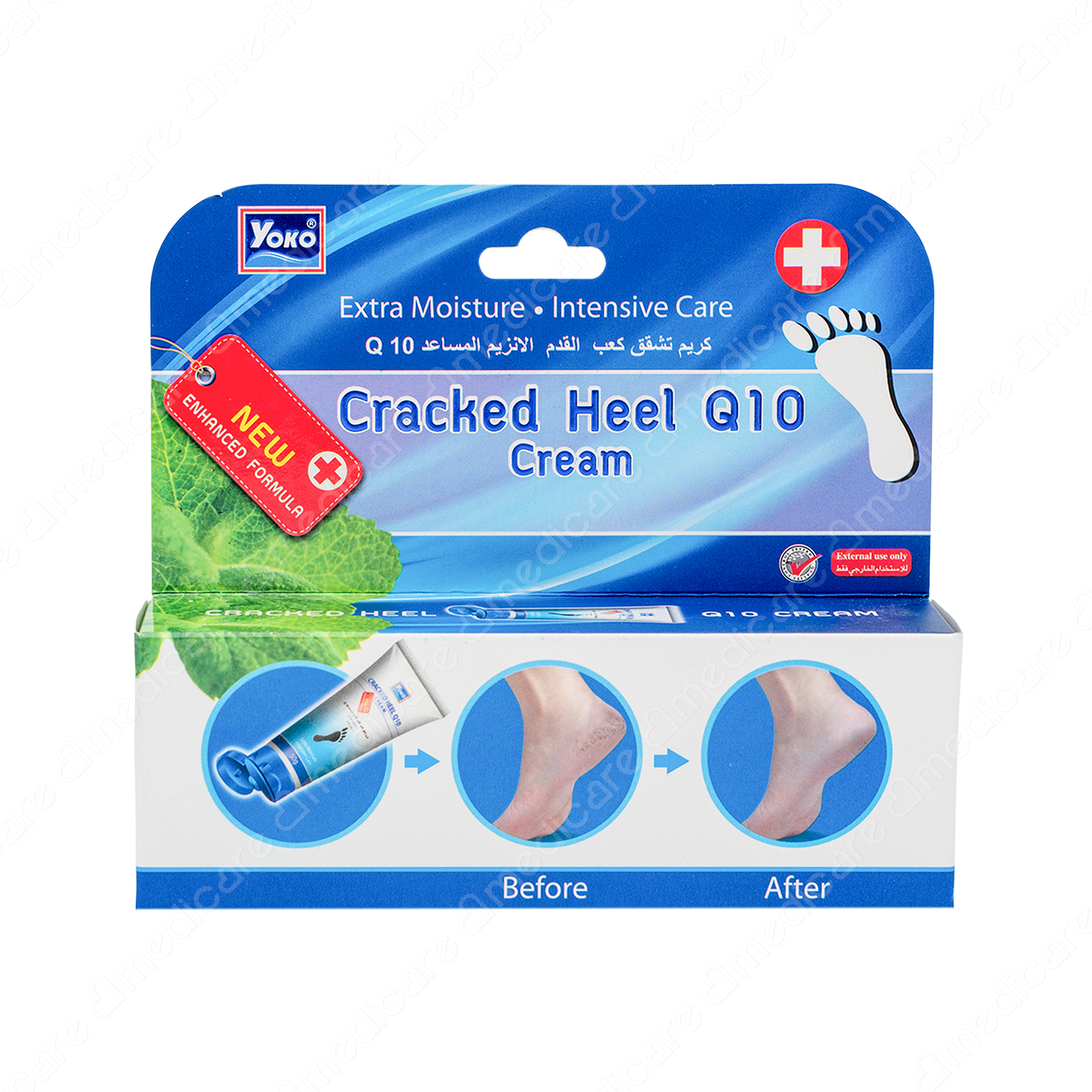 Kem Dưỡng Gót Chân YOKO Heel Q10 | 50g